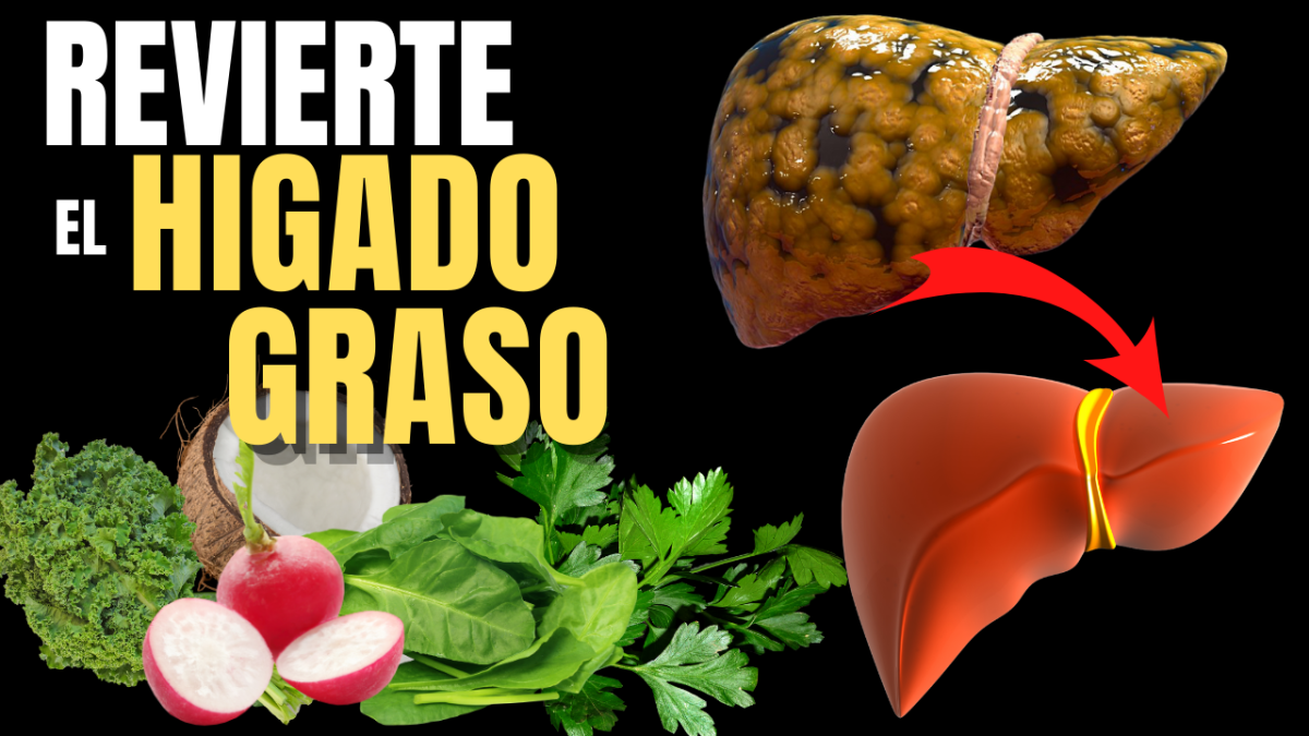 🔴¿CÓMO REVERTIR UN HÍGADO GRASO? - HOW TO REVERSE A FATTY LIVER